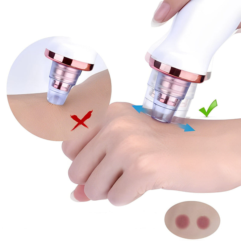 Removedor de Cravos A Vácuo Skin Cleaner